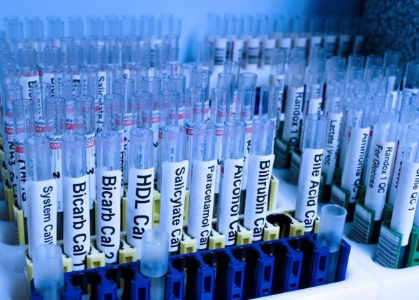 nou instrument de diagnosticare a bolii ficatului gras non alcoolic