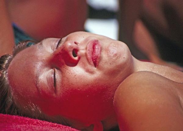 arsurile solare cum le ameliorezi