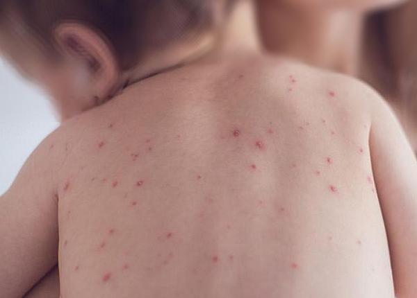 epidemie mortala in romania insp noi cifre