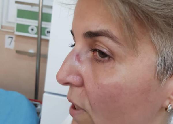 bataie in spital o asistenta din ati sus ine ca a fost agresata de o colega geloasa