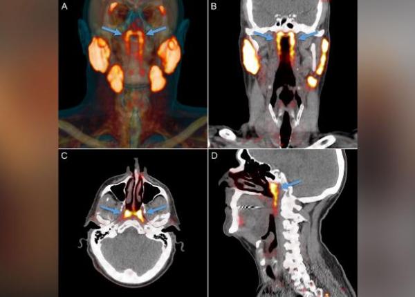 posibil nou organ descoperit in spatele nasului ce rol are i cum de nu a fost vazut pana acum