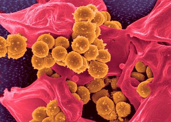 care este diferenta dintre virusi si bacterii dr sandra alexiu explica care este diferenta dintre virusi si bacterii dr sandra alexiu explica