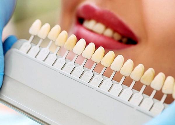 cum sa iti albesti dintii la tine acasa noua metode simple si ieftine