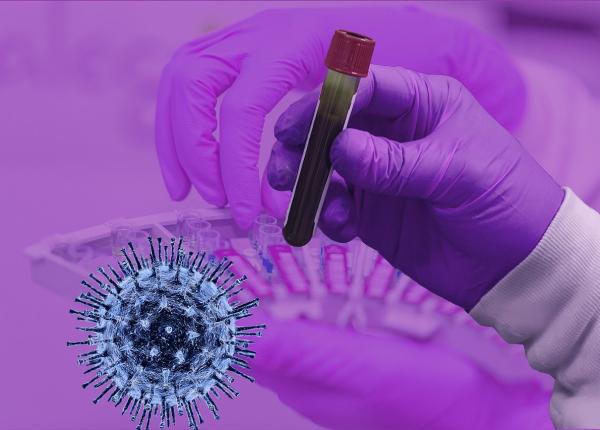 nipah noul virus care creeaza panica in randul oms are gazda comuna cu sars cov 2