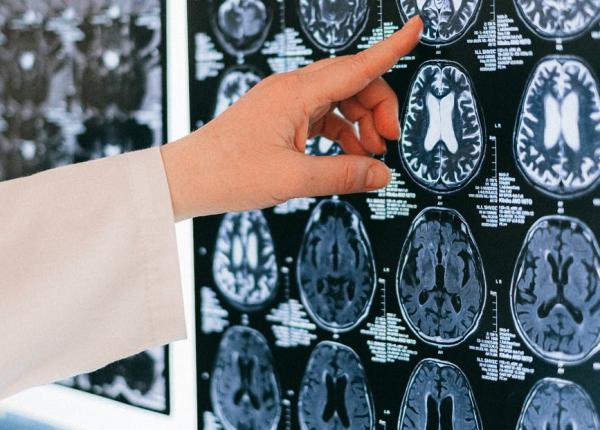 creierul lui mihai eminescu un mister total de ce boala suferea descoperirea care cutremura