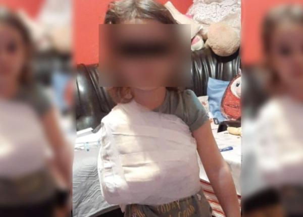 nou scandal la spitalul din corabia ortoped acuzat ca a pus ghipsul peste tricou unei fetite de 4 ani