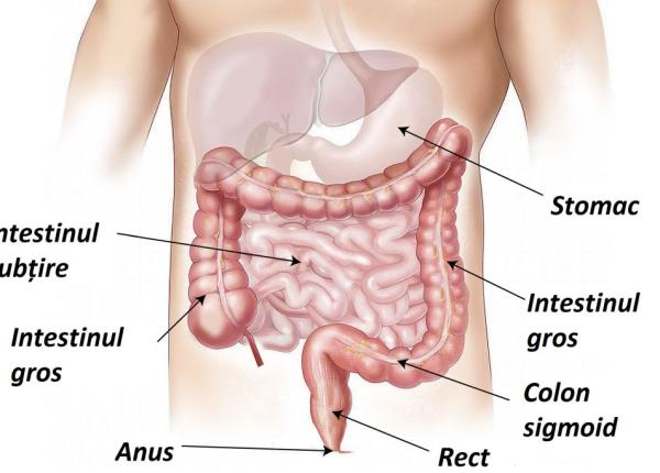ocluzia intestinala ce simptome are cat de periculoasa este si cum se trateaza ocluzia intestinala ce simptome are cat de periculoasa este si cum se trateaza