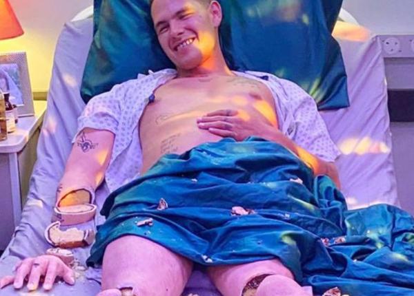 barbat ciopartit pe un pat de spital imaginile fac inconjurul lumii ce se ascunde in spatele acestei poze