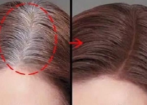 scapa definitiv de parul alb cu aceste doua ingrediente