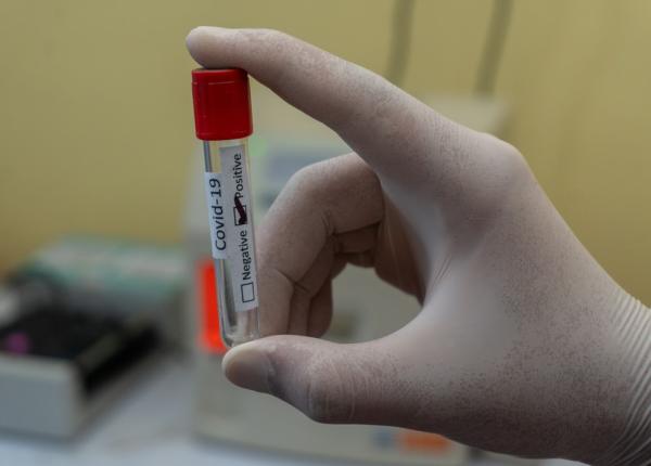 aurul lichid da mapamondul peste cap razboi pe vaccinul covid 19