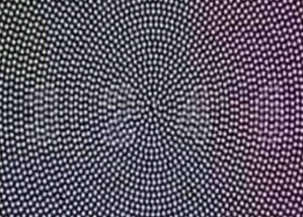 ce vezi in imagine fiecare numar semnifica o anumita problema de vedere