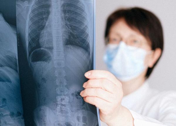 tuberculoza in continuare o problema de santate publica in lume pandemia poate inrautati situatia