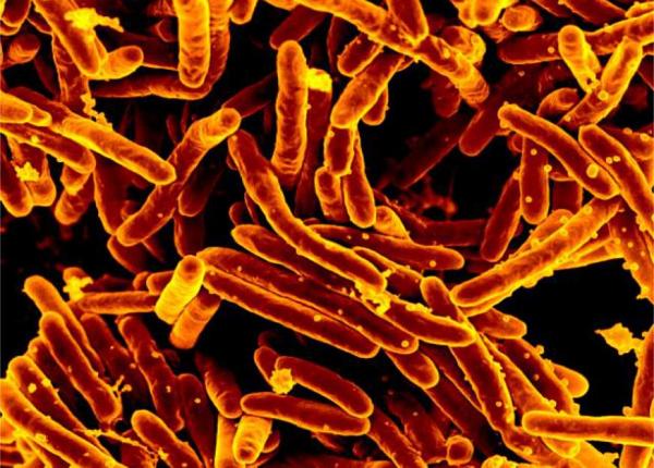 pandemia covid 19 efect nefast in tuberculoza cu 35prc mai putine cazuri diagnosticate pandemia covid 19 efect nefast in tuberculoza cu 35prc mai putine cazuri diagnosticate