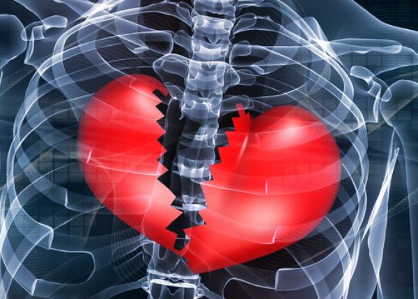 ce trebuie sa faci daca esti singur si faci infarct explicatiile unui cardiolog