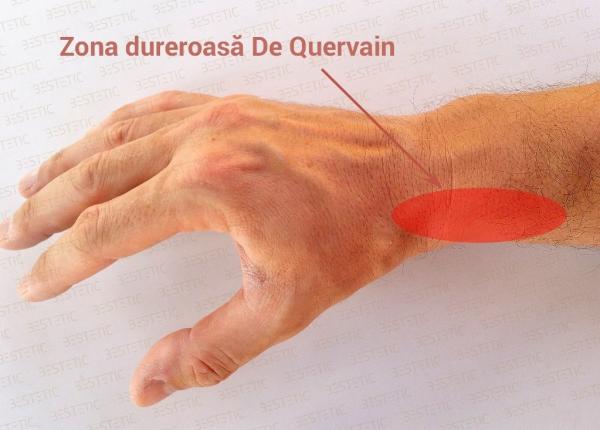 durere la articulatia mainii de ce apare si ce ai de facut