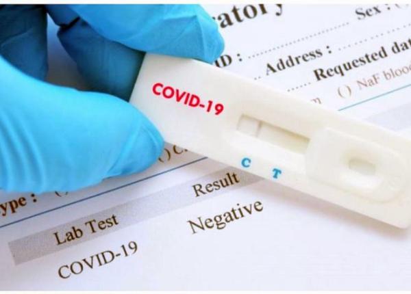 testarea pentru covid 19 se va putea face in farmacii acolo unde vor putea fi amenajate spatii special pentru asta