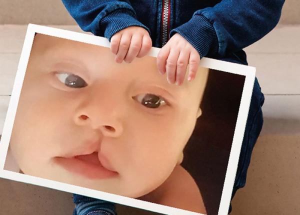 gsk campania zambetele schimba vieti pentru copiii cu despicatura de buza si palat gsk campania zambetele schimba vieti pentru copiii cu despicatura de buza si palat