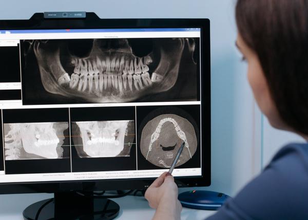 de ce apar cariile dentare desi ne spalam corect pe dinti dr anca vereanu alimente la care avem interzis