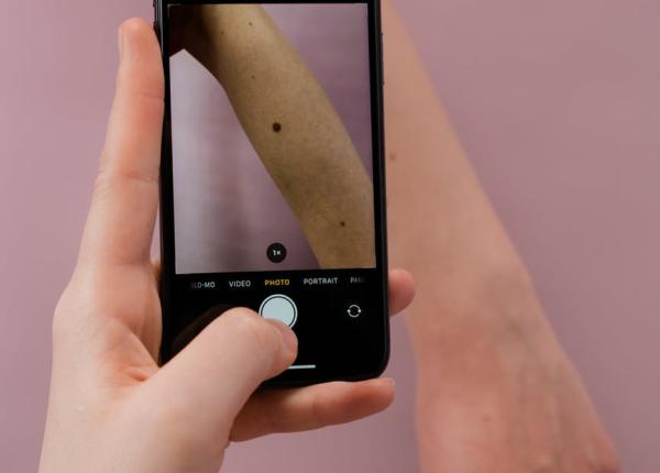 alunite noi de ce apar pe pielela varsta adulta cand e cazul sa te alarmezi