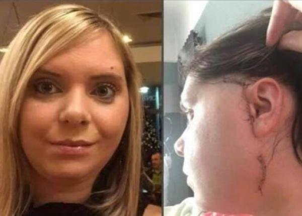 a ajuns direct pe masa de operatie dupa ce a mancat un burger de la un celebru fast food international