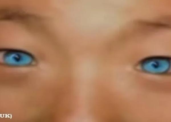 mutatie genetica rara un copil este capabil sa vada in intuneric ca si pisicile