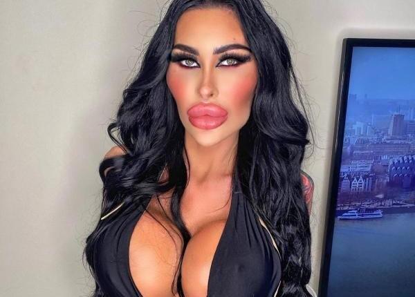 si a marit de cinci ori bustul si a vrut inca o operatie insa medicii au refuzat o iata de ce