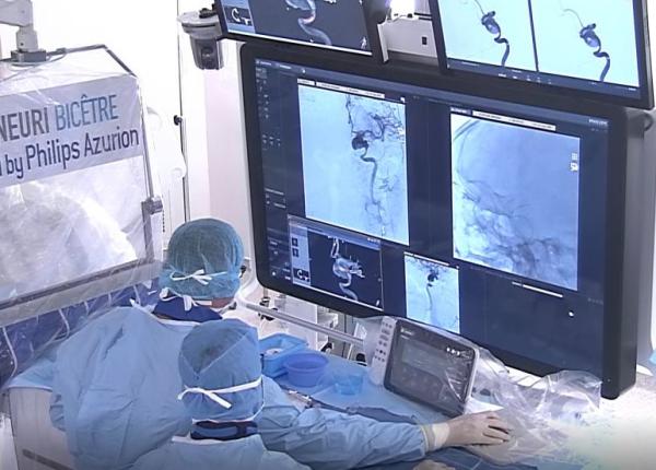 dr cristian mihalea neuroradiologia interventionala solutia pentru afectiuni fatale la creier precum anevrisme malformatii sau avc dr cristian mihalea neuroradiologia interventionala solutia pentru afectiuni fatale la creier precum anevrisme malformatii sau avc
