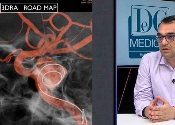 ruptura de anevrism cerebral vinovata de moarte subita la tineri dr cristian mihalea e a doua cauza de deces cum se trateaza ruptura de anevrism cerebral vinovata de moarte subita la tineri dr cristian mihalea e a doua cauza de deces cum se trateaza