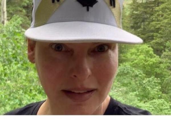 linda evangelista de nerecunoscut dupa o interventie estetica esuata m a deformat