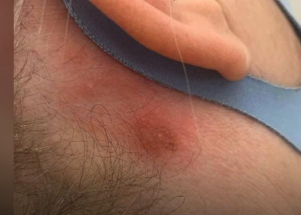 reactii alergice la vopseaua de par la persoanele care au avut covid reactii alergice la vopseaua de par la persoanele care au avut covid