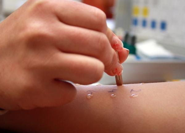 test alergologic inainte de vaccinul impotriva covid 19 cine ar trebui sa l faca si in ce conditii