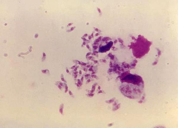 un parazit fatal dar des intalnit ar putea trata anumite tipuri de cancer studiu