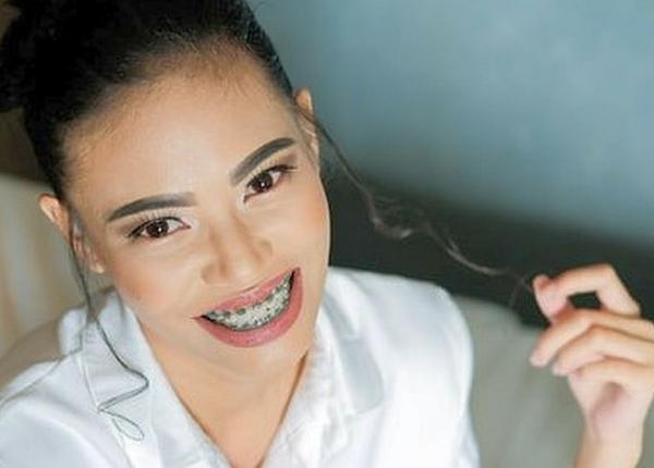 18 lucruri pe care trebuie sa le stii inainte sa ti pui un aparat dentar explicatiile medicului ortodont