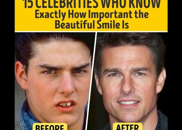staturile de la hollywood care si au aranjat dantura ca sa aiba succes video
