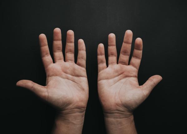 de ce transpira palmele cauzele hiperhidrozei palmare si cum poate fi tratata