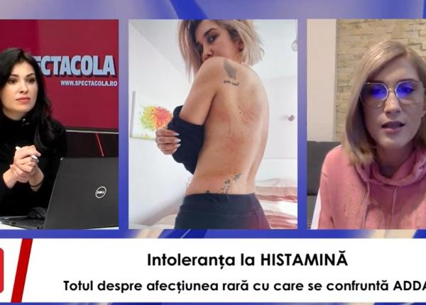 intoleranta la histamina totul despre boala rara cu care a fost diagnosticata adda interviurile spectacola dc news si dc medical intoleranta la histamina totul despre boala rara cu care a fost diagnosticata adda interviurile spectacola dc news si dc medical