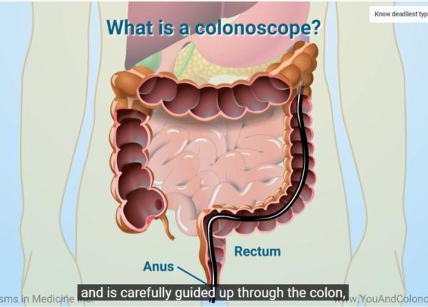 cand se face endoscopia si care este scopul ei