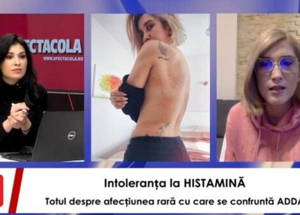 adda totul despre intoleranta la histamina boala rara cu care a fost diagnosticata am avut momente in care nu puteam sa respir
