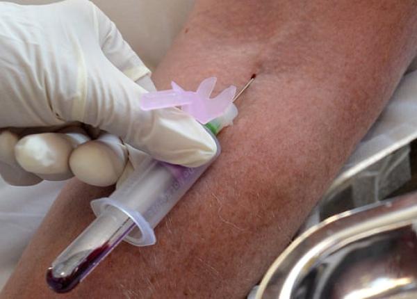 testul de sange care ar putea ajuta la detectarea cancerului chiar si in lipsa simptomelor specifice