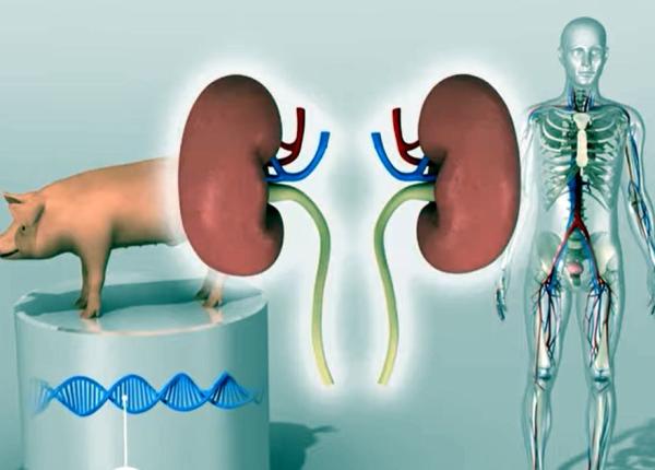 cercetatorii au reusit un transplant de rinichi de la porc la un om in moarte cerebrala primul om cu inima de porc se recupereaza dupa transplant video cercetatorii au reusit un transplant de rinichi de la porc la un om in moarte cerebrala primul om cu inima de porc se recupereaza dupa transplant video