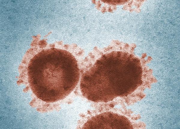 a treia zi de record zilnic de infectari in rusia circ 63 000 de noi cazuri covid