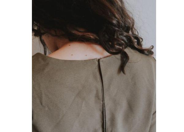 leziuni care seamana cu niste cosuri atentie ultimul stadiu e desfigurant imagini de nedescris nasul se face ca un cartof