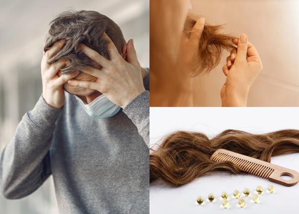 caderea parului efect al long covid studiu alarmant