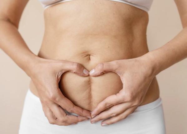 chirurgia single port vs chirurgia prin gaura cheii dr horia cioflan nicio cicatrice incizii foarte mici intre 5 12 mm