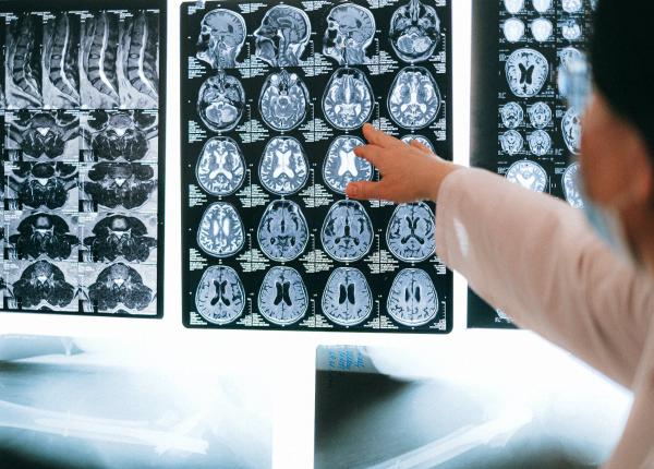 complexitatea creierului muresanu putem gasi si substitui pana la un punct anumite functii ale creierului