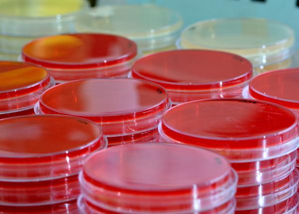 stafilococul auriu cat de periculos este de fapt