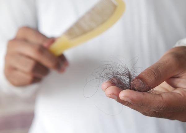 alopecia cauze simptome tratament legatura dintre alopecie si anxietate