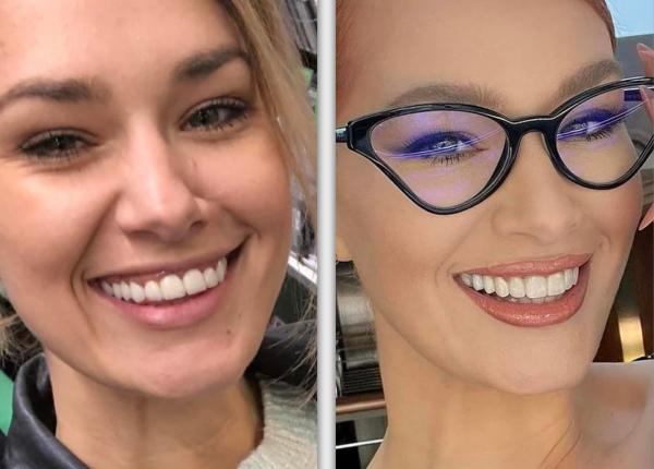 feli medic stomatolog si a refacut dintii