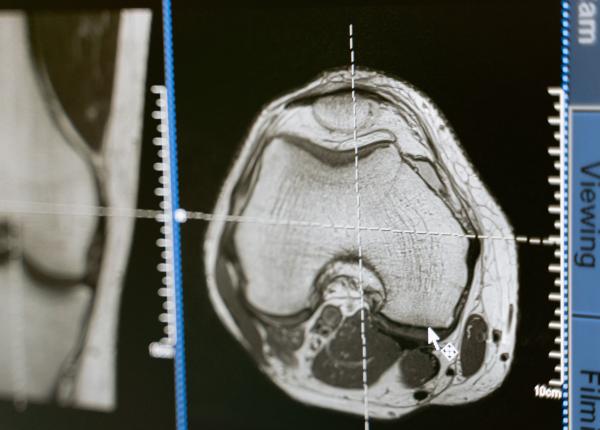 testele imagistice utilizate des in diagnostic