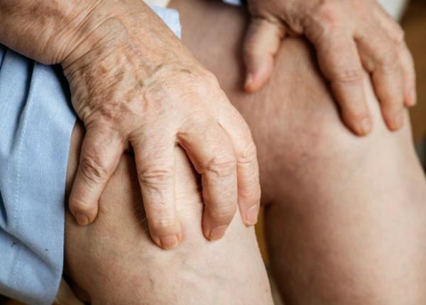 ce este gonartroza boala care afecteaza tot mai multe femei si tineri dr dragomir simptomul extrem de frecvent